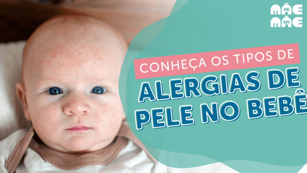 Alergias de pele em bebês