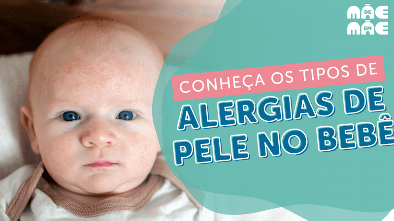 Alergias de pele em bebê: quais são as mais comuns?