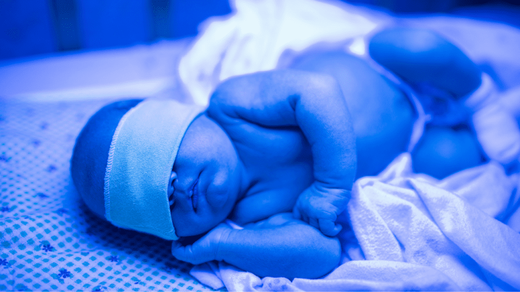 Icterícia neonatal tratamento com banho de luz