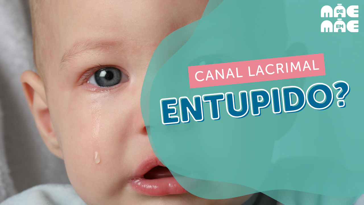Você está visualizando atualmente O que é obstrução do canal lacrimal?